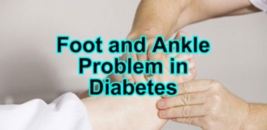 Foot and ankle problems