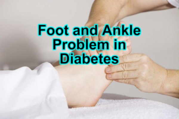 Foot and ankle problems