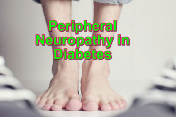 Peripheral Neuropathy