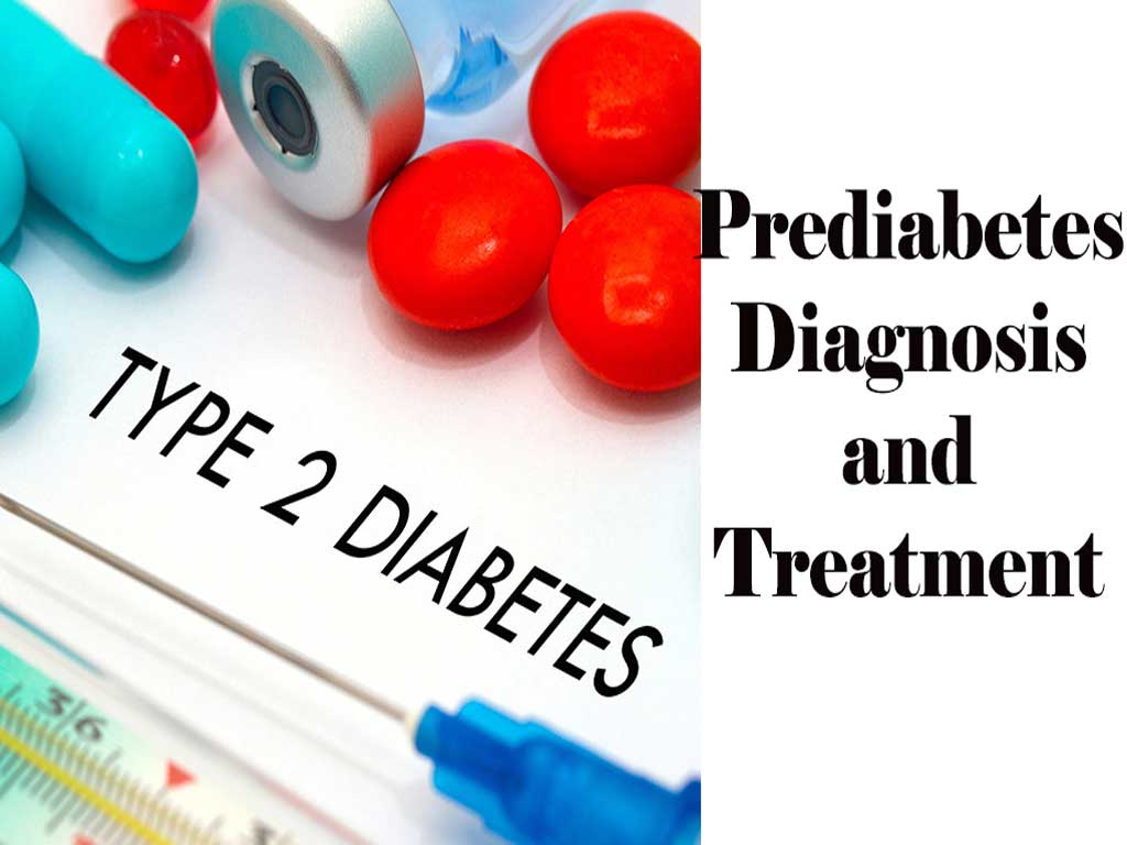 Prediabetes Diagnosis and Treatment